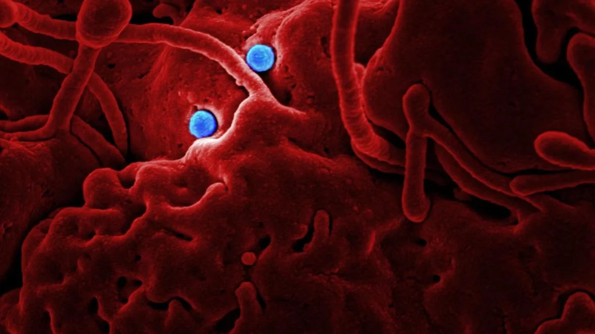 Coloured scanning electron micrograph showing viral particles (blue) on a red cellular surface.